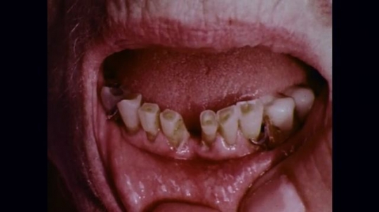 1970s: Closeup of teeth being brushed, flossed, and pointed at with dental instruments.
