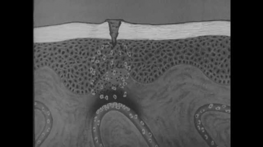 1930s: Drawing of skin and cells underneath, with cut in skin. Cells form under cut and multiply, eventually forming web with each other.